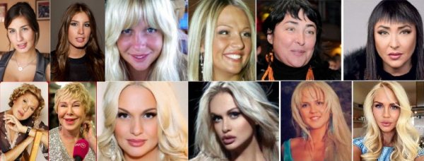 Фото до и после пластики